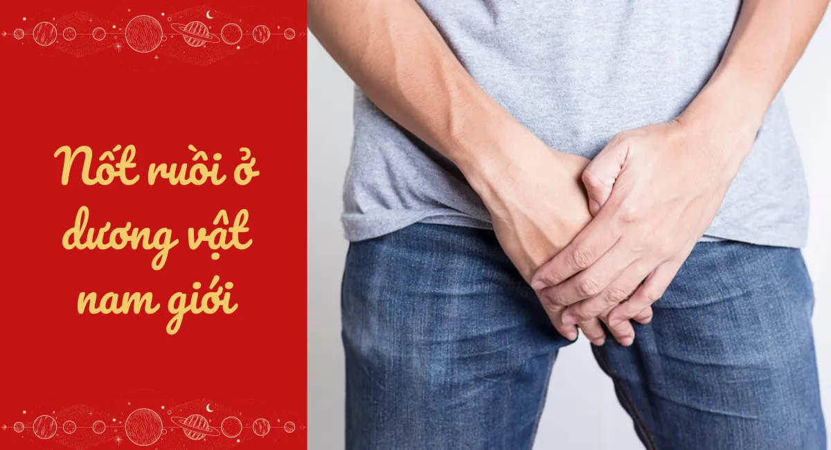 Nốt ruồi ở dương vật nam giới: Điềm báo phong lưu đa tình hay là tai ách bệnh tật?