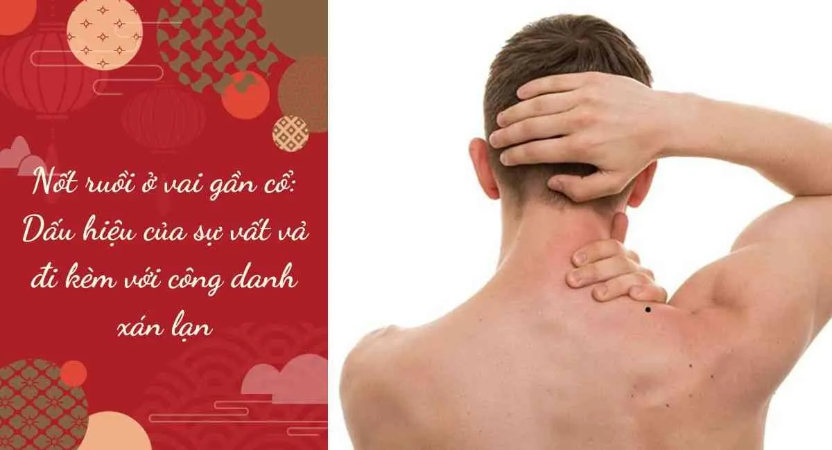 Nốt ruồi ở vai gần cổ: Dấu hiệu của sự vất vả đi kèm với công danh xán lạn