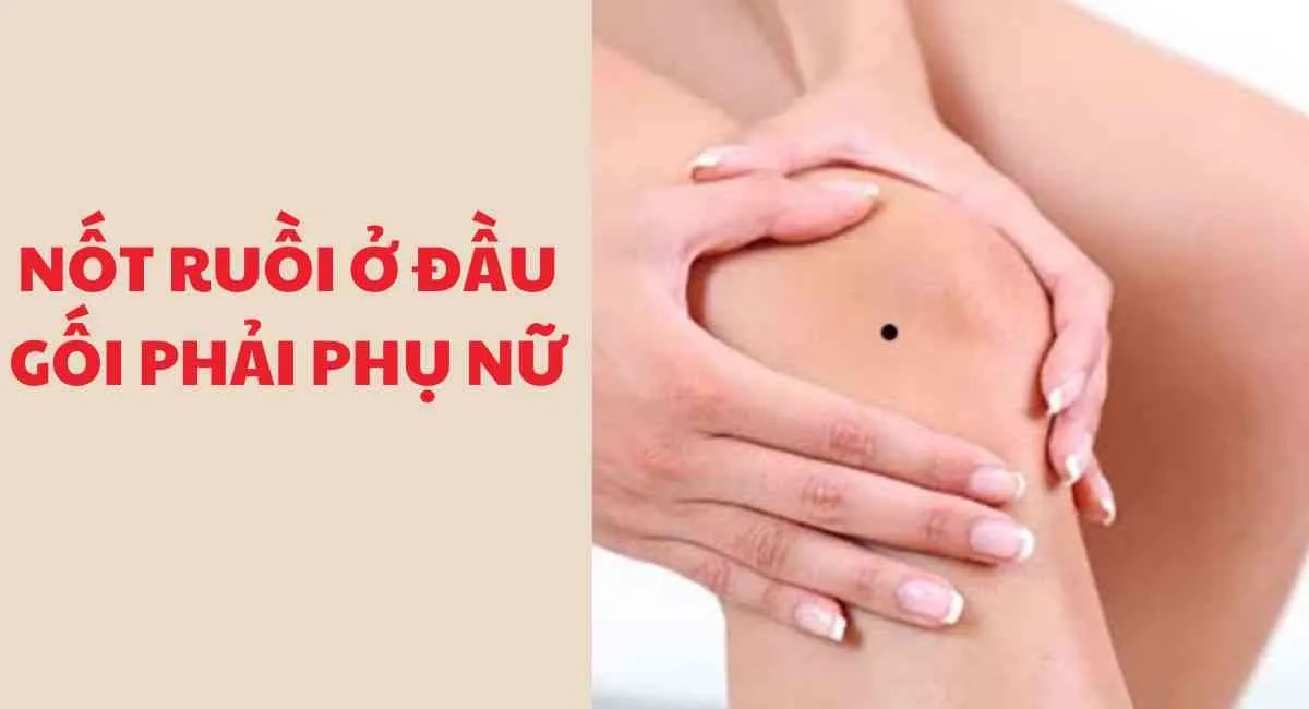 Soi tướng nốt ruồi ở đầu gối phải phụ nữ: Cả đời không lo toan nếu làm việc này